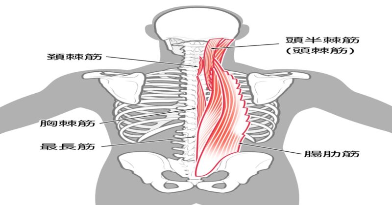 原因不明の高熱のカギとなる脊柱起立筋