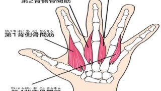 へバーデン結節の原因となる骨間筋