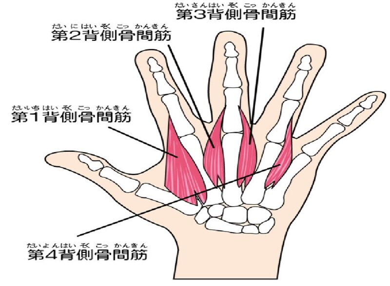 へバーデン結節の原因となる骨間筋