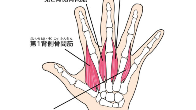 へバーデン結節の原因となる骨間筋