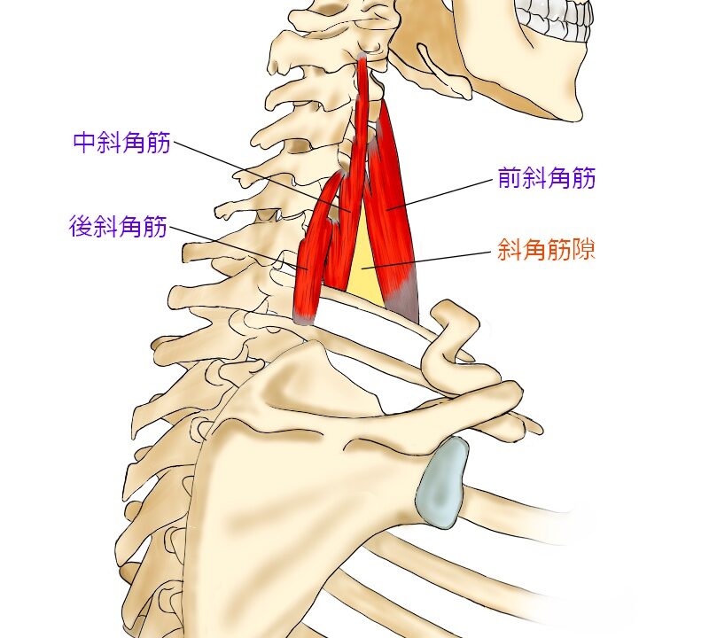 肩前側（腕の付け根）の痛みの原因となる斜角筋
