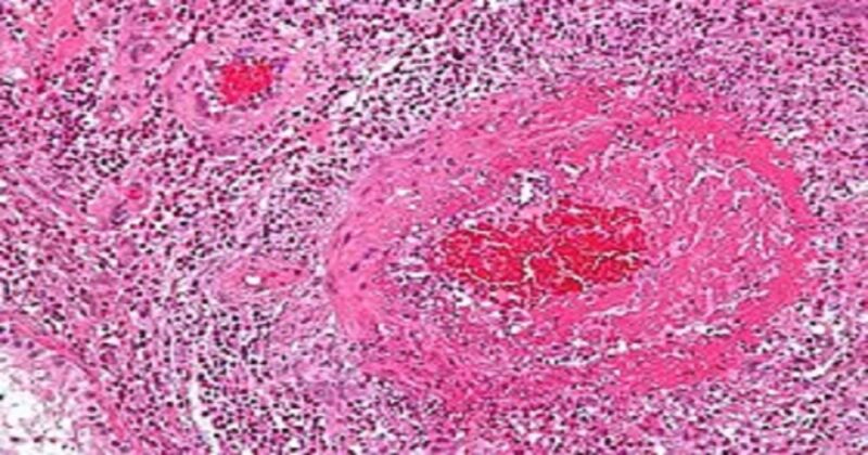 どのように診断されるのでしょうか?