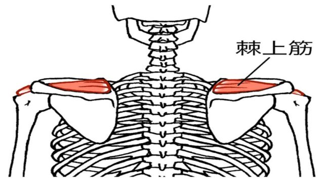 肩の痛みの原因となる棘上筋