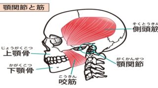 顎の痛み（顎関節症）の原因となる咬筋