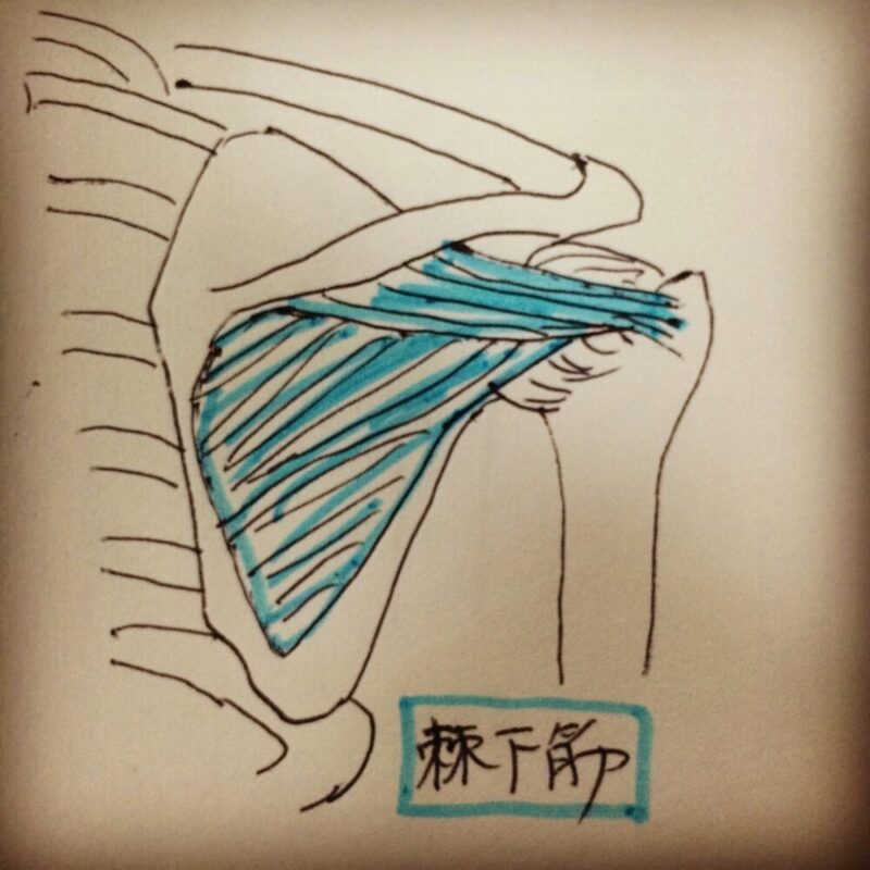 肩前方部の痛みの原因となる棘下筋