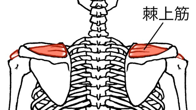 肩の痛みの原因となる棘上筋