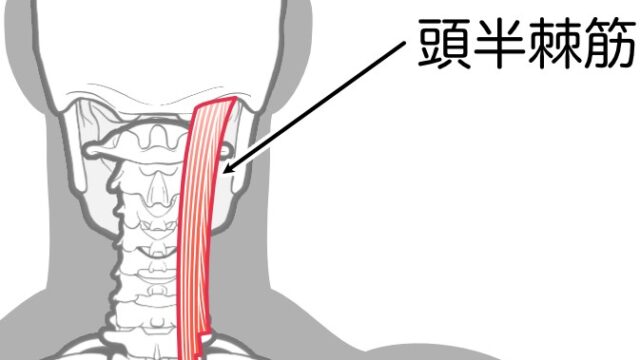 頭痛の原因となる頭半棘筋